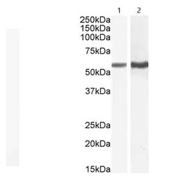 ab121024Abcam Anti-TGF beta Receptor I 抗体