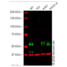 ab235578Abcam Anti-TGF beta Receptor I 抗体