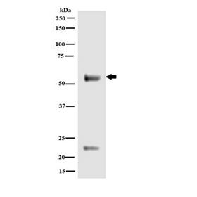 CALR11-AAlpha Rabbit anti-Mouse Calreticulin (CALR) antibo