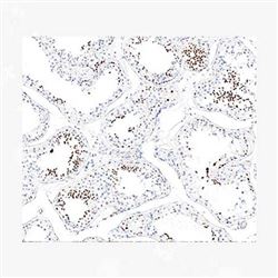 ZA-0671中杉金桥 睾丸核蛋白（NUT）抗体试剂