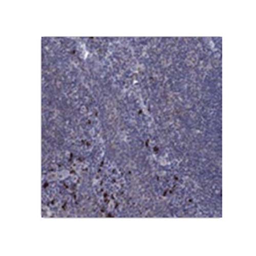 Atlas Antibodies  Anti-PVR 25ul
